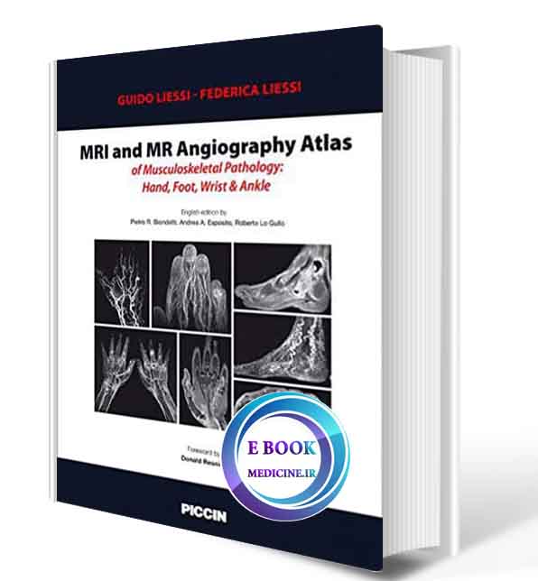 دانلود کتابMRI and MR Angiography Atlas of Musculoskeletal Pathology: Hand, Foot, Wrist & Ankle2020( ORIGINAL PDF)